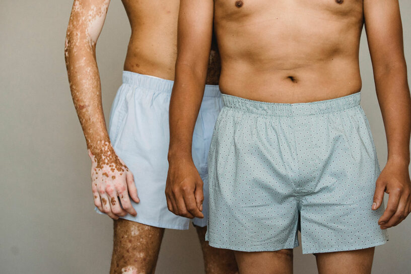 ¿Influye el tipo de calzoncillo en la fertilidad del hombre?